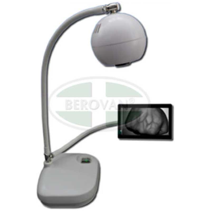 MS-VEIN-VIEWER-BM1000-400x475